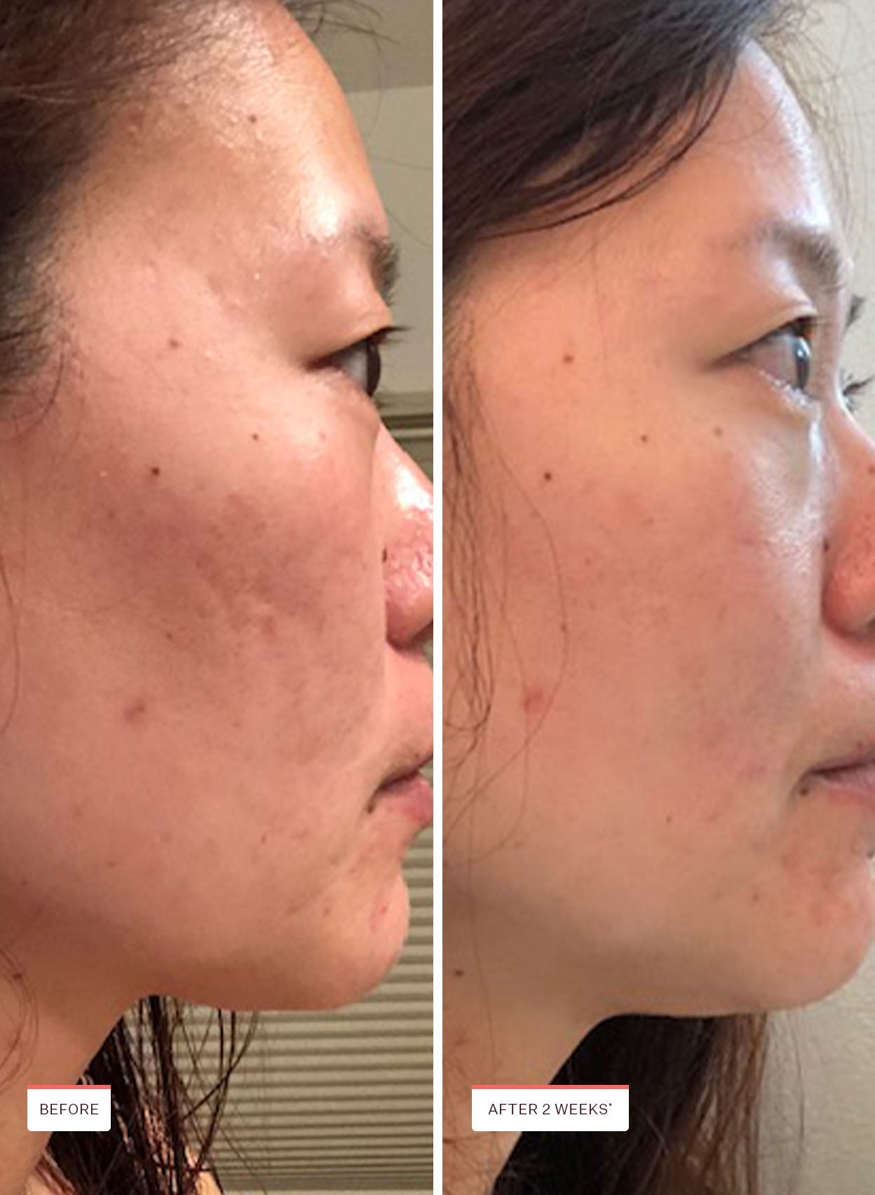 Glass Skin Refining Serum